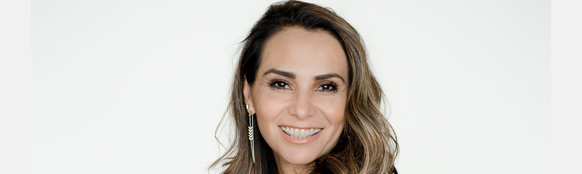 Porcelain Ceramic Braces Treatment in Long Beach CA